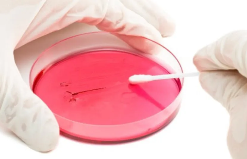 Placa de cultura sendo semeada com um swab em laboratório